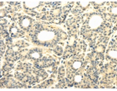 兔抗TBC1D22A多克隆抗体