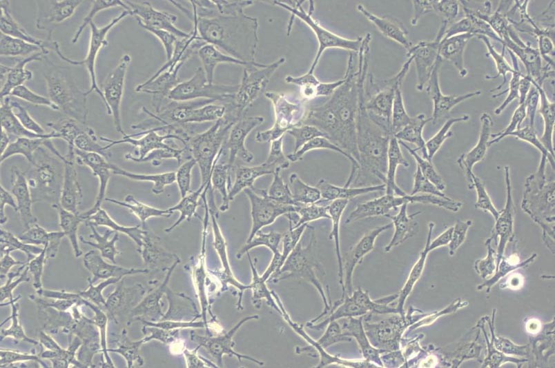 A172人胶质母细胞瘤细胞