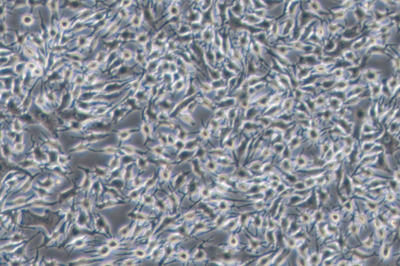 B16-F1小鼠黑色素瘤细胞