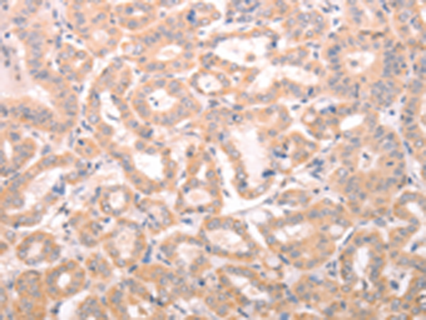 兔抗ABHD12多克隆抗体