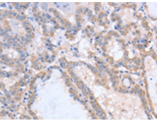 兔抗ACVR1C多克隆抗体