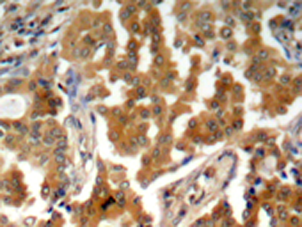 兔抗ADD1 (Phospho-Ser726) 多克隆抗体