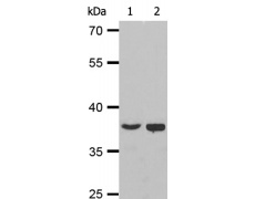兔抗ACP5多克隆抗体