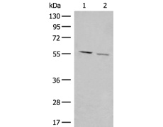 兔抗GADL1多克隆抗体