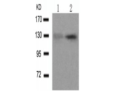 兔抗ADD1 (Phospho-Ser726) 多克隆抗体