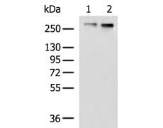 兔抗ABCA1多克隆抗体