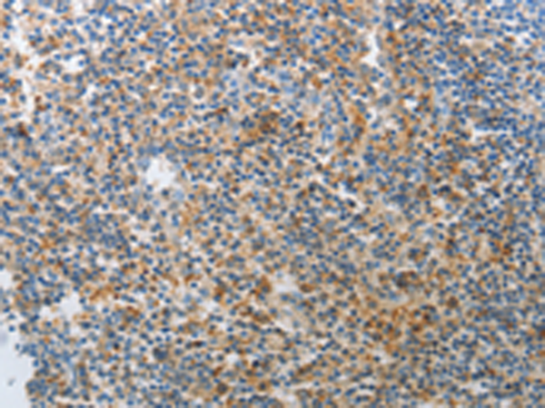 兔抗AD7C-NTP多克隆抗体