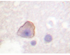 兔抗ADD1(Ab-726) 多克隆抗体