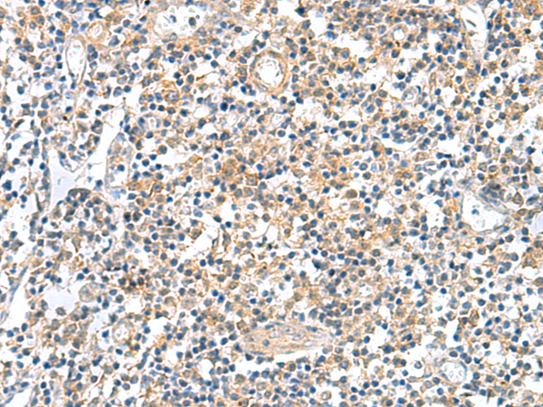 兔抗GEMIN7多克隆抗体 