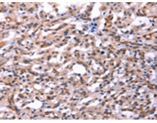兔抗GCG(GLP2)多克隆抗体 