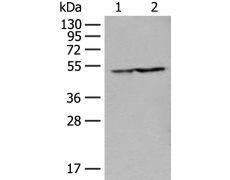 兔抗GDI2多克隆抗体