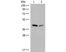 兔抗GIPC1多克隆抗体  