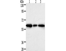 兔抗AKR1A1多克隆抗体