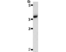 兔抗AKR1B1多克隆抗体