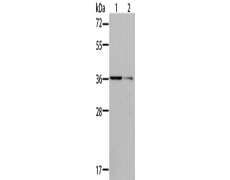 兔抗AKR1B10多克隆抗体