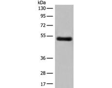 兔抗GK5多克隆抗体   