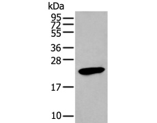 兔抗GKN1多克隆抗体  