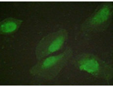 兔抗AKT1(Ab-326) 多克隆抗体