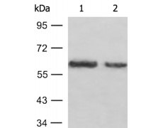 兔抗AKT1(Ab-473)多克隆抗体