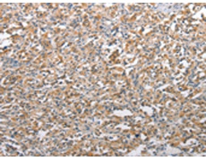 兔抗TSC2多克隆抗体 