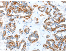 兔抗ALDH5A1多克隆抗体