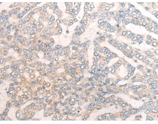  兔抗TSG101多克隆抗体  