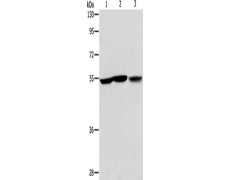 兔抗ALDH9A1多克隆抗体