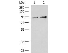 兔抗TTC14多克隆抗体   