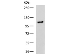 兔抗TTC16多克隆抗体  