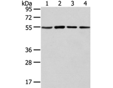 兔抗TUBA1C多克隆抗体   