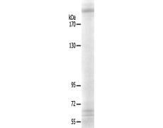  兔抗TUBGCP6多克隆抗体   