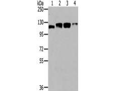 兔抗UBA1多克隆抗体