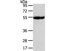 兔抗UBAP1多克隆抗体  