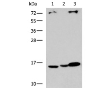 兔抗UBE2D1多克隆抗体   