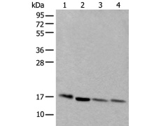  兔抗UBE2D3多克隆抗体