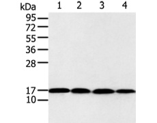 兔抗UBE2I多克隆抗体   