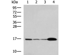  兔抗UBE2N多克隆抗体