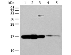 兔抗UBE2V1多克隆抗体
