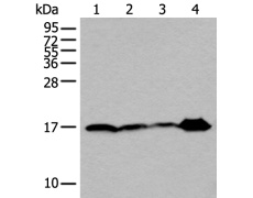  兔抗UBE2V2多克隆抗体 