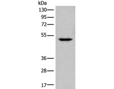兔抗UBR7多克隆抗体