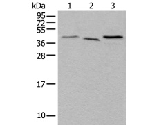 兔抗UBXN1多克隆抗体 