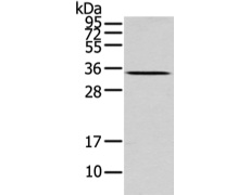 兔抗UCP2多克隆抗体 