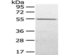 兔抗UGP2多克隆抗体   
