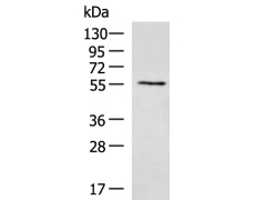 兔抗UGT2B4多克隆抗体   