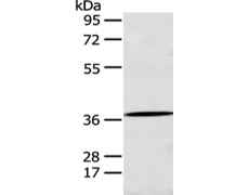 兔抗ANXA10多克隆抗体