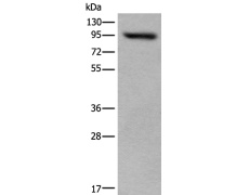 兔抗USP6NL多克隆抗体 