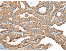 兔抗USP12多克隆抗体