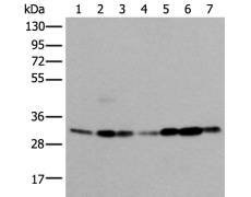 兔抗VDAC1多克隆抗体 
