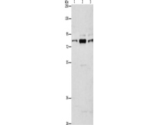 兔抗ARHGEF7多克隆抗体