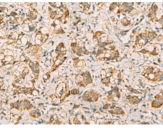 兔抗VTA1多克隆抗体  